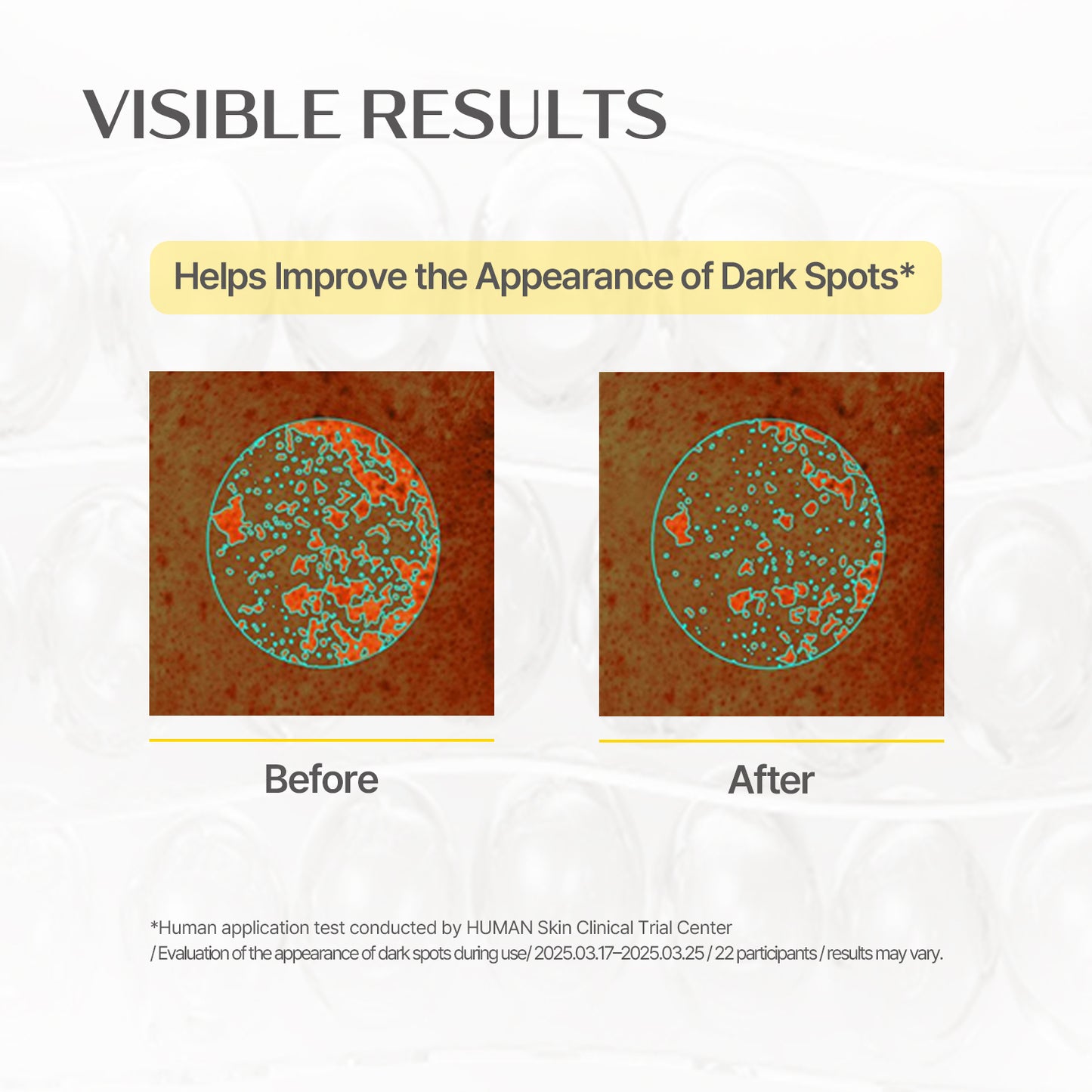 Glutathione Blanc Ampule