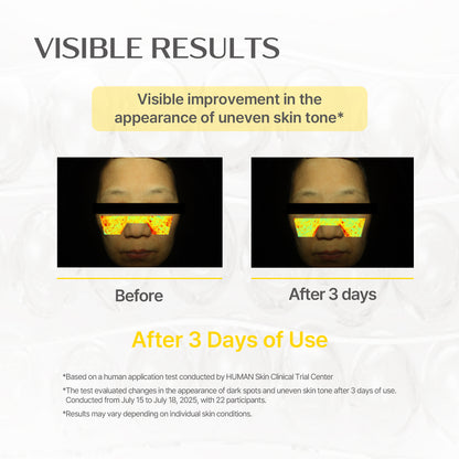 Glutathione Blanc Ampule