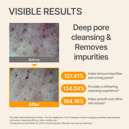 Rice Foaming Cleanser